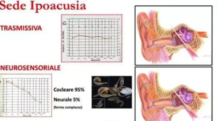incontro-ipoacusia-immagine